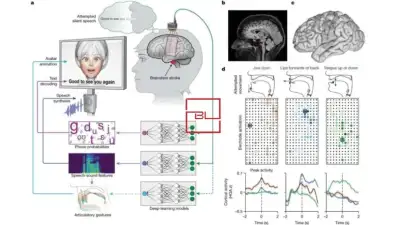 Woman with severe paralysis to communicate with brain-computer interface
